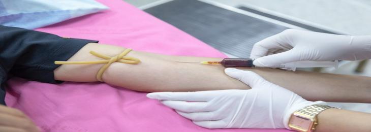 Blood Test May Help Detect Often-Missed Minor Strokes