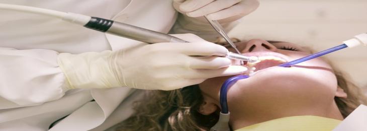 Iron-oxide nanoparticle enzyme may help tackle dental plaque build-up