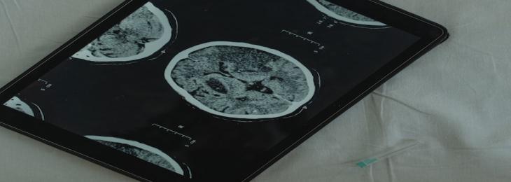 System Using Fluorescence Imaging to Show Tumor Depth